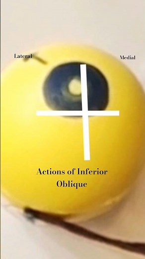 Rough eye model for actions of EOM- IO| Watch full video to learn more #optometry #ophthalmology
