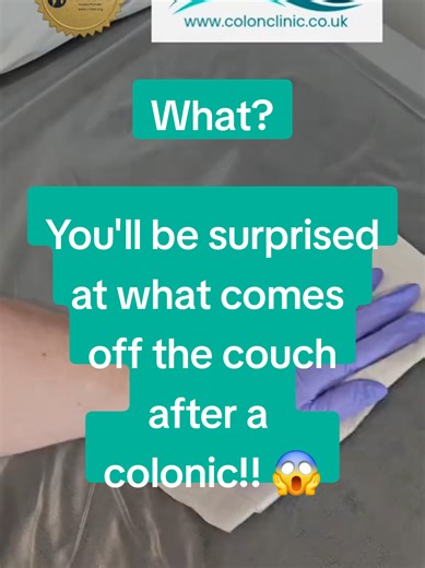 😱 You’ll never believe what came off the couch after a colonic… Watch closely — I wipe the bed… flip the tissue… and there it is ... Sometimes the body says it all without a single word. If you’re ready to feel lighter, clearer, and more energised from the inside out, let’s talk. 🌿 www.colonclinic.co.uk 📞 07841 474988 📧 erica@colonclinic.co.uk #colonictherapy #guthealth #colonhydrotherapy #detox #colonictrainer @Gut Girls @Colonic Trainer Erica @Colonic Angel