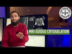 Sydney's New MRI Machine That Freezes Tumors | A Beautiful Innovation In Radiology