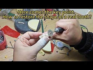 Explore a Step in the Denture Making Process‪@denture‬ fabrication