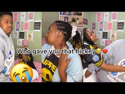 HICKEY PRANK ON MY BOYFRIEND