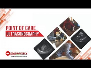 FAST - Pneumothorax Ultrasound