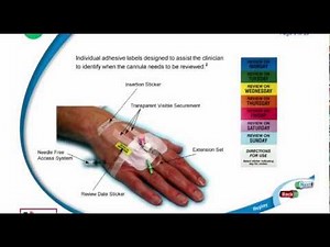 Cannulation e-Learning Demonstration