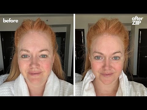 ZIIP Beauty's New HALO At-Home Facelift Device | Review, Before + After, and Exclusive Discount Code
