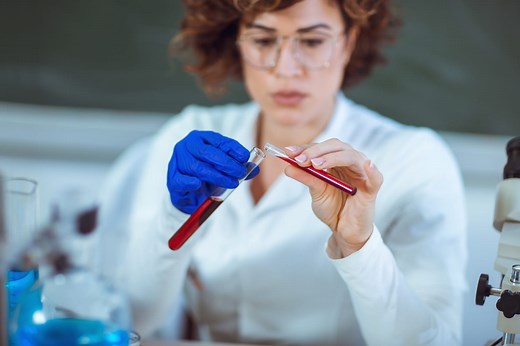 VGM élevé, bas : ce qu'indique votre prise de sang