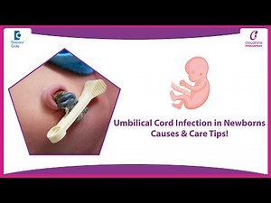 Umbilical Infection in Newborn | Pus Discharge from Belly Button - Dr. Meena | Doctors' Circle