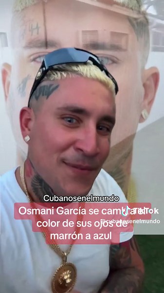 Color Changing Eyes: Osmani García Transformation from Brown to Blue
