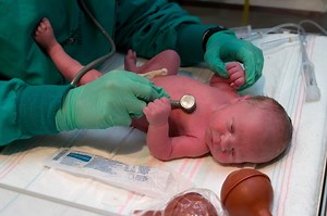 Neonatal hypoglycemia: causes, risks and treatment