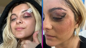 Bebe Rexha Struck in Face With Cellphone During NYC Show - The Global Herald