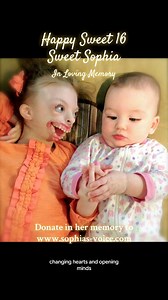 Happy Sweet 16 #SweetSophia To honor Sophia’s memory please donate to www.sophias-voice.com #inmemory #happybirthday #love #disability #childloss #grief #facialdifferences | Natalie Weaver