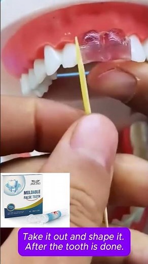 Fix your smile fast with moldable plastic pellets easy DIY false tooth repair at home! #tooth #diy