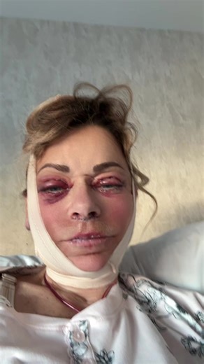 Videos de chirurgie au mexique (@chirurgie.au.mexi) con “son original - chirurgie au mexique”