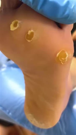 400K views · 2K reactions | You won’t believe what came out of this toenail N843 Beautiful moments of care and relaxation through a gentle pedicure experience. Simple, clean, and satisfying. ✨ Disclaimer: This video is for educational and relaxation purposes only. All content belongs to the respective owners, no copyright infringement is intended. | Tanim | Facebook