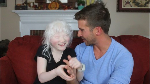 23M views · 421K reactions | Johanna is diagnosed with albinism, blindness and a rare neurological disorder. She was adopted after being found wandering alone at a market in China. To her new family's surprise, she has been nothing but joyful since the first time they met. | Special Books by Special Kids | Facebook