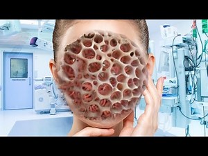 ASMR Animation treatment from infected Women's Face | 2D Animation