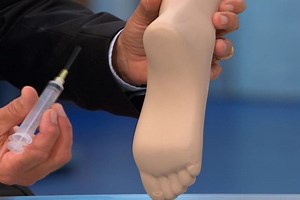 Botox For Your Feet? New Study Shows Promise — But Not For Wrinkles