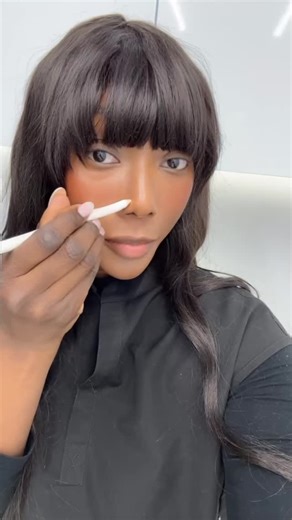 Farah Infirmière Médico-Esthétique on Instagram: "Saviez-vous qu’il est possible d’affiner l’apparence du nez avec le Botox ? Voici les points d’injection que nous utilisons pour obtenir un résultat subtil, harmonieux et naturel. Did you know that Botox can help refine the appearance of the nose? Here are the injection points we use to achieve a subtle, balanced, and natural-looking result #injection#botox#nurse#asthețic#astheticnurseinjector"