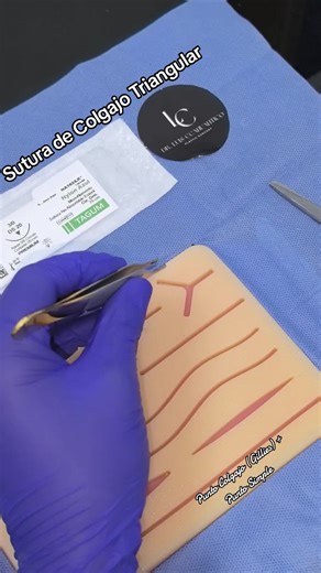 Sutura de heridas con Colgajo Triangular con Punto de Colgajo (de Gillies) y punto simple. #suture #sutura #plasticsurgery #CirugíaPlástica #fyp #nudos #sutura #colgajo