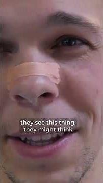 Mouth Breather This One Thing Changed Everything