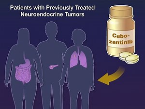Cabozantinib for Advanced Neuroendocrine Tumors | NEJM