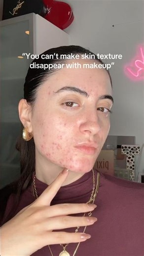 How to use makeup to remove skin texture!! 🫢 #realskintexture #makeuptutorial #acnecoverage