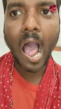 Overcoming Advanced Tongue Cancer with Hemiglossectomy and Reconstruction