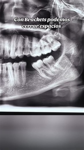 DentikaBrackets on TikTok