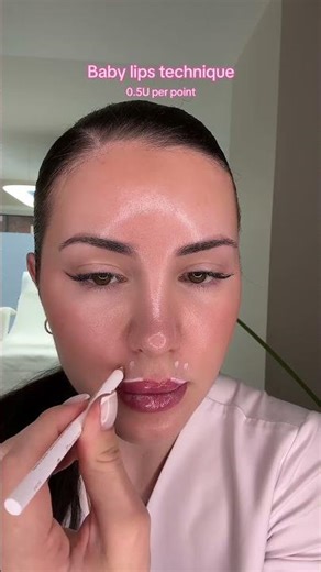 Lip flip with Botox - different techniques.