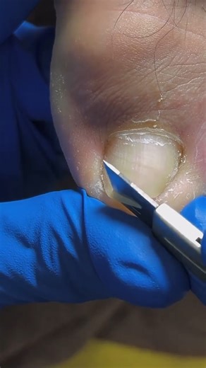 Pedicure Knife | Nail Salon