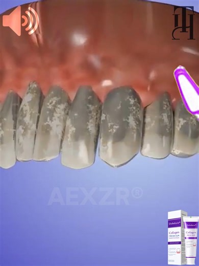 ⚠️ Stop the Spit-Stain Panic! ⚠️ Be honest: when you spit after brushing, do you secretly check for a little pink? That bleeding or irritation isn't normal, and it's a huge confidence killer. Most toothpastes only clean your teeth, but they ignore the foundation of your smile—your gums! Introducing Dobshow® Collagen Fresh-Gum Renew Toothpaste. We're the first to deliver collagen peptides directly to your gums. Think of it as a super-protein building block that helps your gums get back to being s