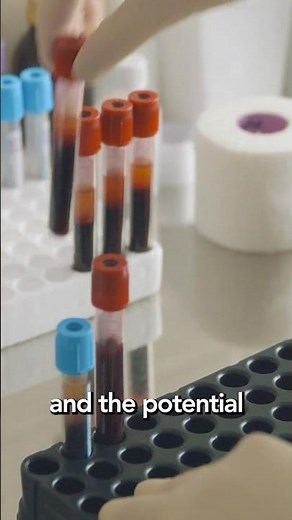 What's next in cancer research? We asked OICR's Dr. Michelle Brazas...