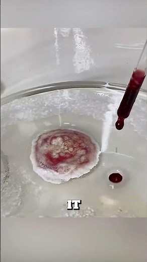 Why Hydrogen Peroxide Is Bad for Wounds 😳