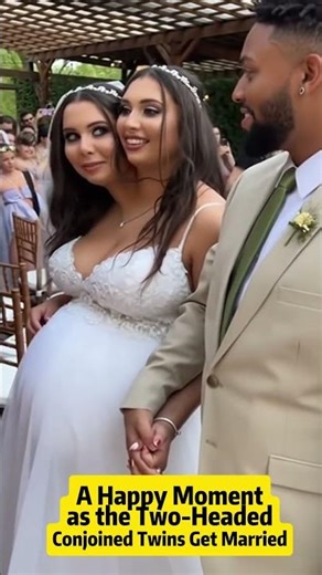 Two Headed Woman Finds True Love and Finally Marries Her Dream Man