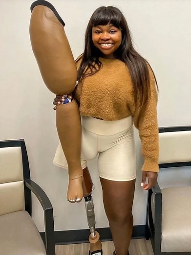 5.4K views · 11 reactions | The Inspiring Bionic Beauty: 凉Her Journey to Self-Love and Shattering Society’s Rules ✨Her Strength And Amazing Photos Find IN The First Comment And Be Ready To Get Amazed⬇️⬇️⬇️ | About Interesting | Facebook