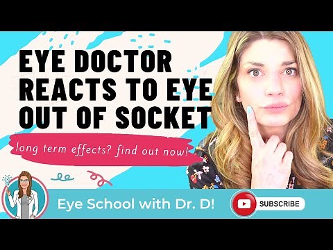 Eye Doctor Reacts to Eye Injury | Eye Out of Socket | Optometrist Reacts to Eye Trauma