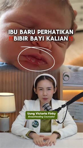 ASI BOOSTER MOM UUNG on Instagram: "Mommy disini udah tau istilah LIP BLISTER?🤔 Si gelembung kecil atau garis putih di bibir bayi yang sering muncul setelah nyusu🥹 Biasanya karena pelekatan (latch) yang belum optimal, mulut bayi belum bisa membuka lebar, bibirnya belum “dower”, sehingga saat menyusu bibir bayi jadi bekerja lebih keras dan terus bergesekan dengan puting. Kalau dibiarkan, gesekan ini bisa bikin area bibir bayi melepuh dan muncullah lip blister tadi.🔎✨ Lalu gimana cara mengatasi