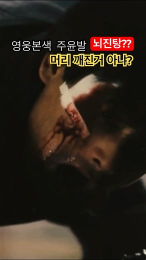 영웅본색 주윤발, 영화찍다 뇌진탕? 머리깨진거 아님??