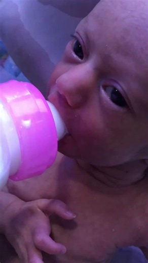 baby bottle feeding time NICU CARE #nicubabycare