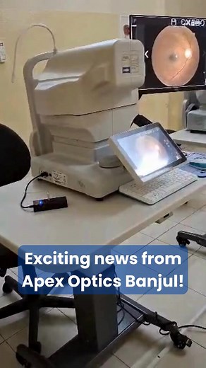 Your eyes deserve the best 👁️✨We’ve upgraded! From OCT scans to eye ultrasound, we now offer hospital-grade diagnostics — right here in Banjul.🩺 Walk in today. See clearer, live better.📍 Apex Optics, Independence Drive📞 236 9999 | 📲 WhatsApp: 220 2369999#ApexOptics #BanjulEyeCare #VisionMatters #OCT #FundusScan #EyeHealthGambia | Apex Optics