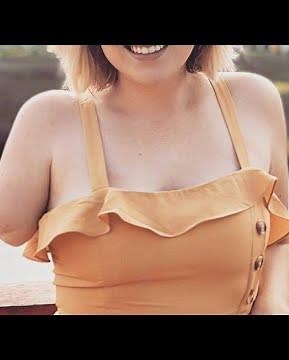 The beautiful woman has an amputated arm and life with one arm #amputee #amplife