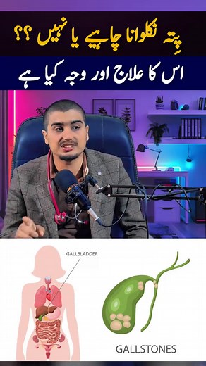 Gallstones: Symptoms, Causes & Natural Treatment