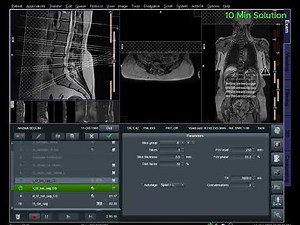 How to MRI of Lumbar Spine | MRI Lumbar Spine Planning & Positioning Tutorial