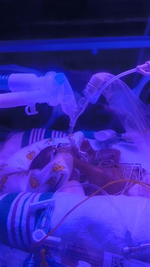 Don't tell me not to be happy because my baby might start down falling cause that will get you curse the fucc out in my comments section!, don't speak negative over him period cause baby it's too many people praying for him for that negativity!!!!! I get some y'all might have experienced less success with such small babies but don't bring your traumas to my comment section! There's someone seeing this that gets hope from how good my #25weeks baby is doing!!!! But Cayson said hey y'all. #preemies