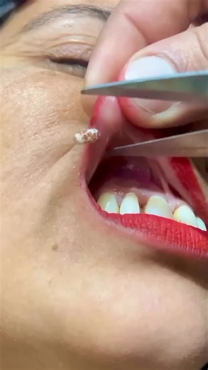 Top ASMR Sounds to Relax and Unwind