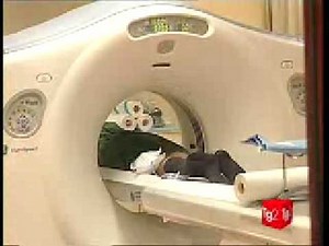 Colonscopia virtuale