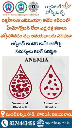 Anemia – Symptoms, Causes & Treatment Explained | Blood Disorder Awareness | Capital Hospitals
