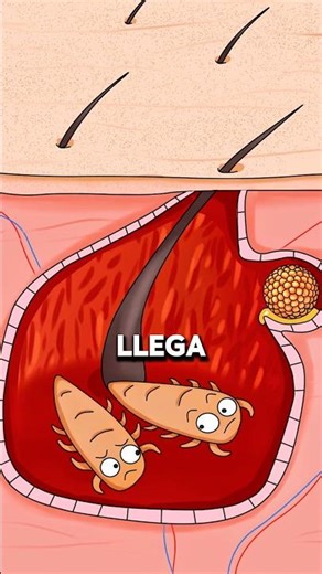 Por qué los granos reaparecen constantemente en la piel grasa ⚠️..!! #salud #fypシ #acne #pielgrasa