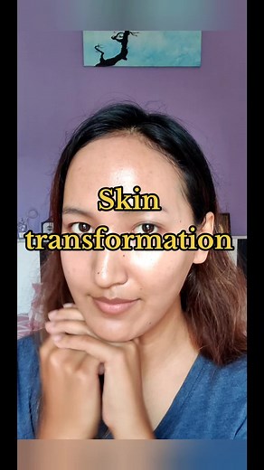 Skin Transformation with Retiderm: A Complete Skincare Routine