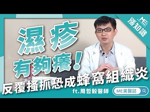 皮膚｜濕疹可能會引起蜂窩性組織炎？醫師教你如何正確對抗濕疹 ft.皮膚科周哲毅醫師【ME美醫誌】