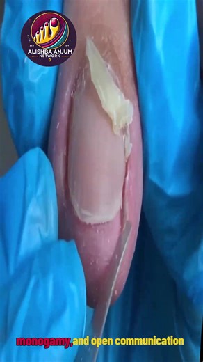 15K views · 70 reactions | Brittle toenails: smart tips to ease pressure, swelling  #SeniorHealth #WellnessSeniors #EverydayCare | Alishba Anjum vlog | Facebook